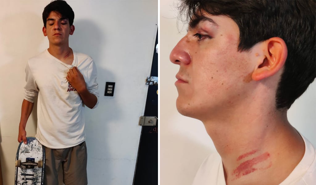 Joven es golpeado por policías de Tulancingo