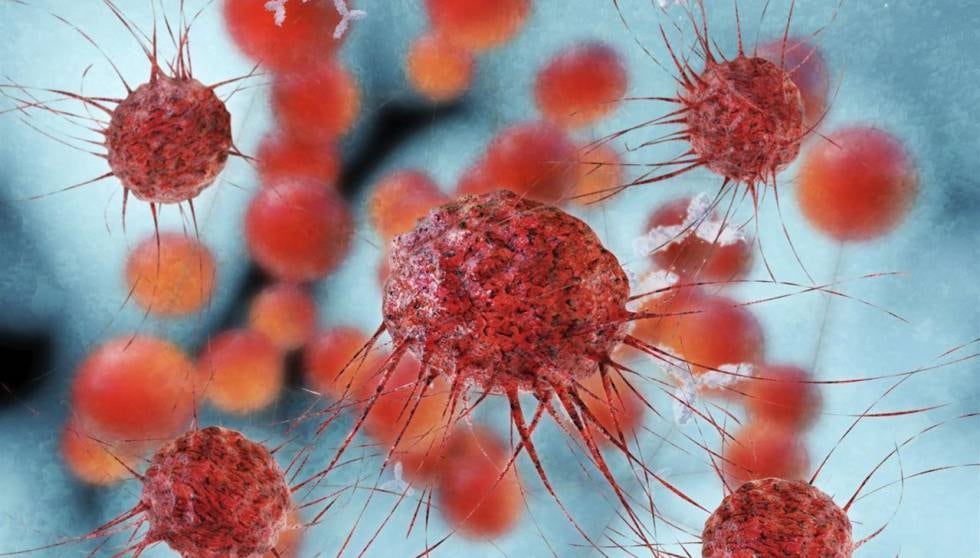 Inyectan por primera vez virus que podría matar el cáncer