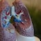 ¿Qué es trombosis pulmonar? La afección que mató a Elena Larrea