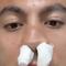 Luis Cárdenas sufrió fractura en la nariz; su agresor no fue expulsado