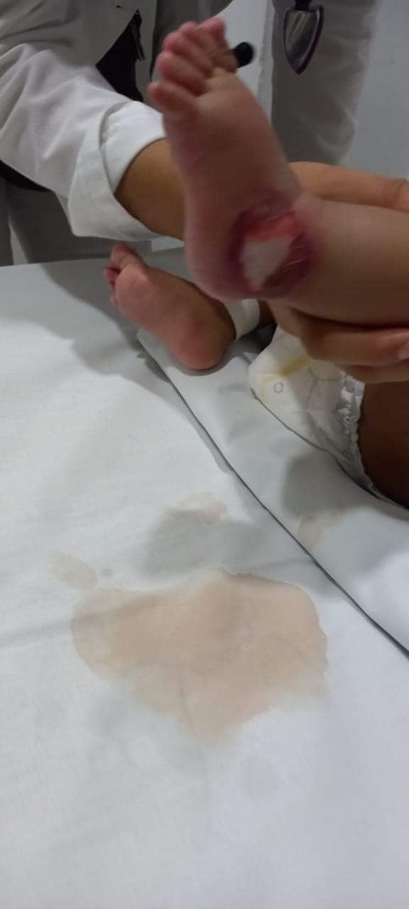 Acusan negligencia hacia bebé de tres meses en hospital comunitario de Puebla