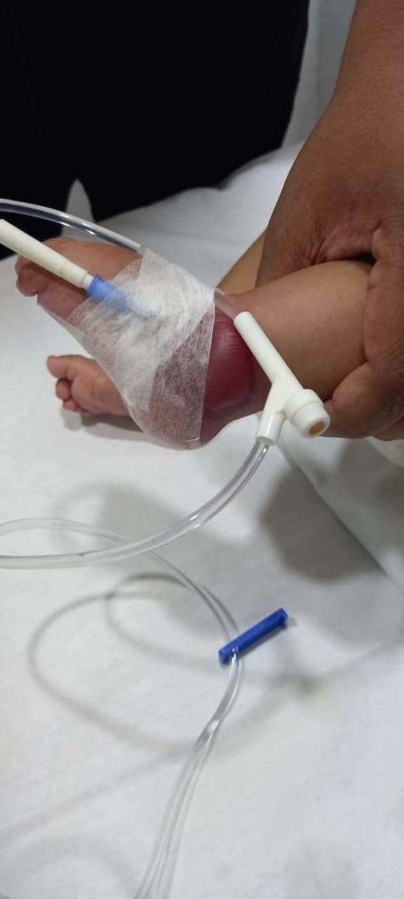 Acusan negligencia hacia bebé de tres meses en hospital comunitario de Puebla